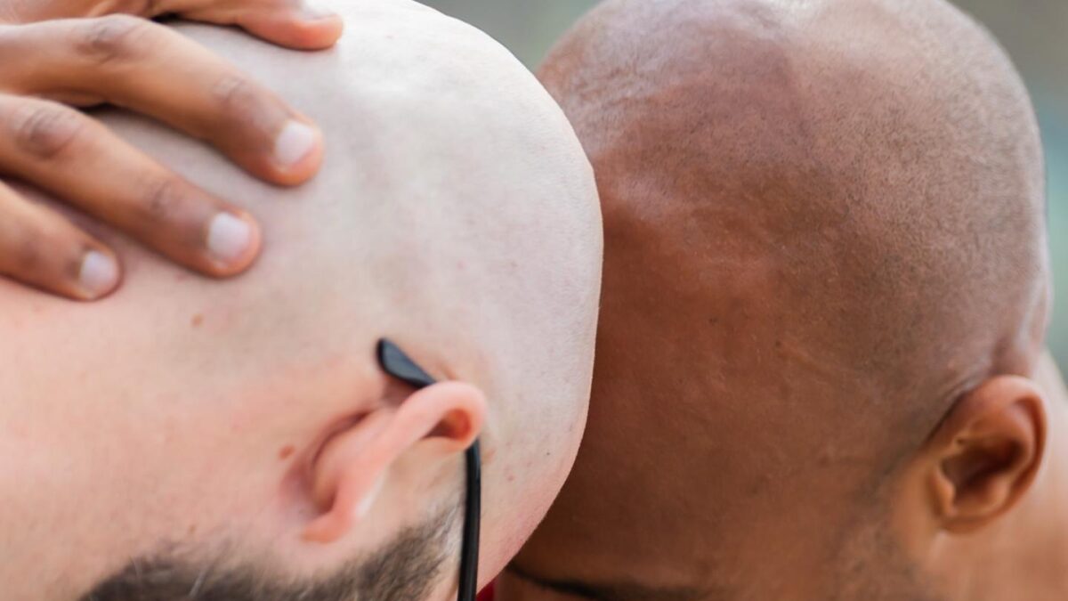 People with bald heads are taking part in the "Berlin Bald Festival" for bald people in Görlitzer Park.
